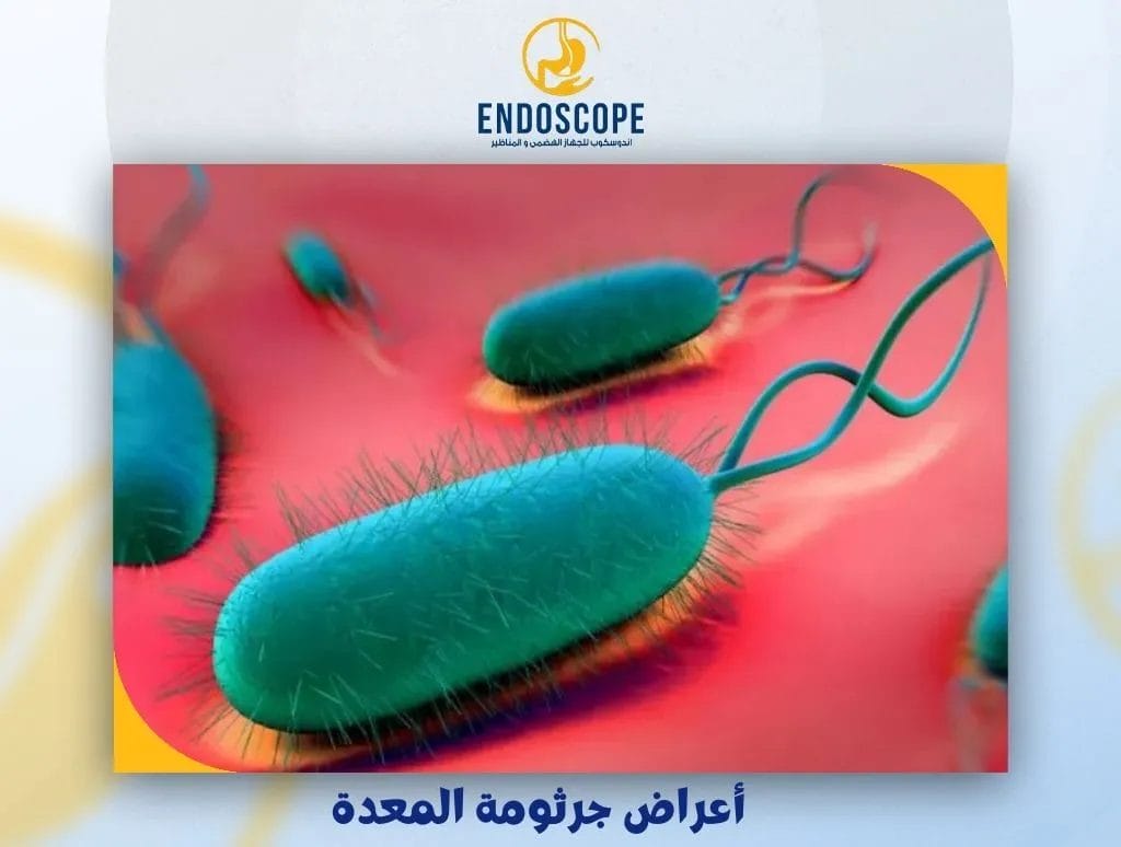 أعراض جرثومة المعدة