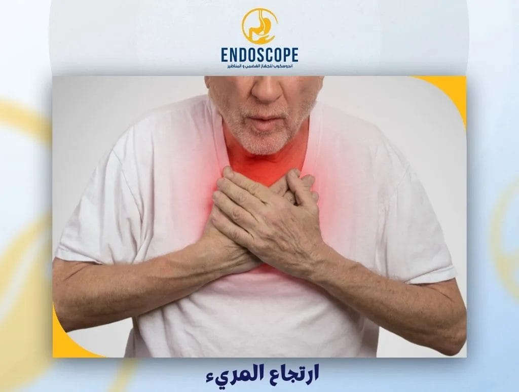 ارتجاع المريء