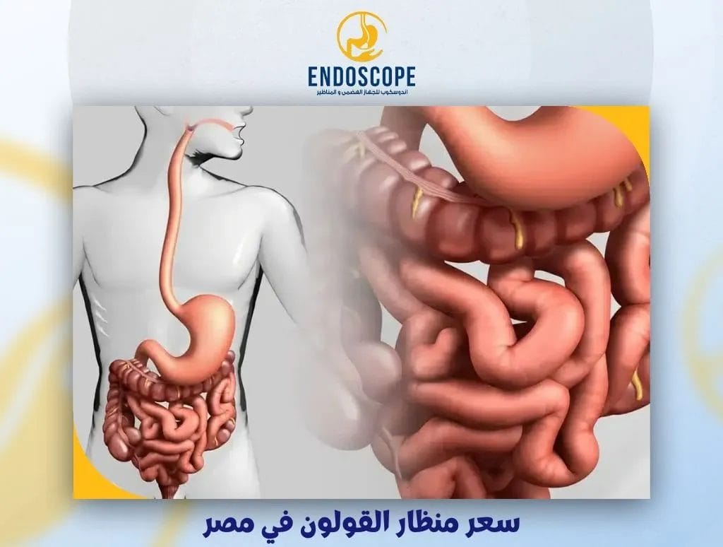 سعر منظار القولون في مصر