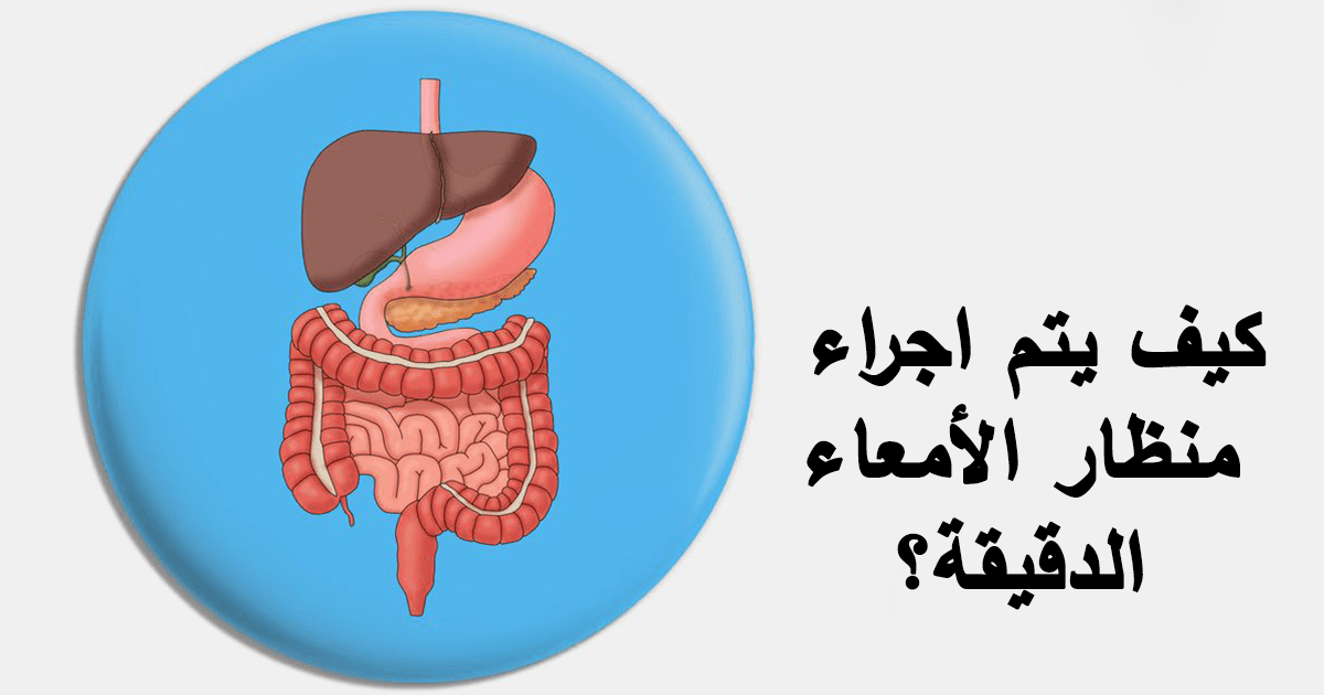 كيف يتم اجراء منظار الأمعاء الدقيقة؟