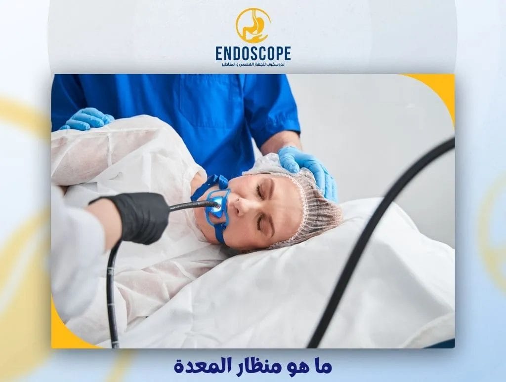 ما هو منظار المعدة