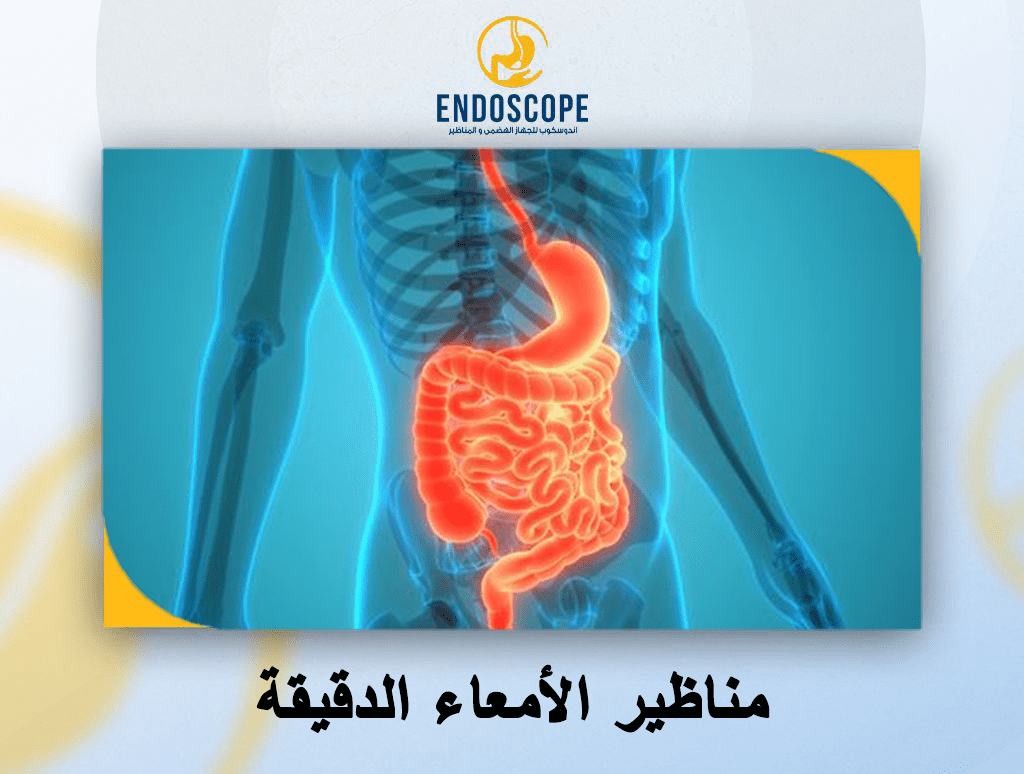 مناظير الأمعاء الدقيقة 