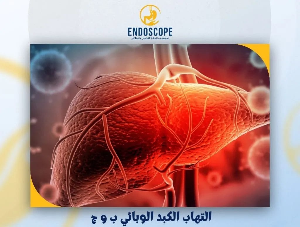 التهاب الكبد الوبائي ب و ج