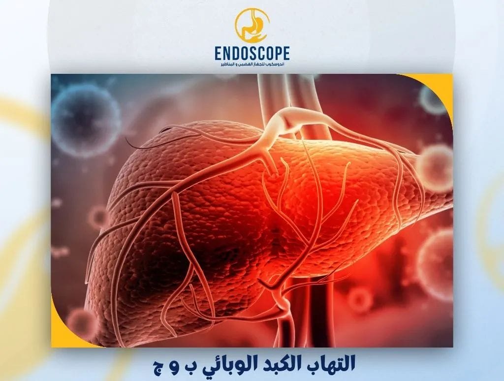 التهاب الكبد الوبائي ب و ج