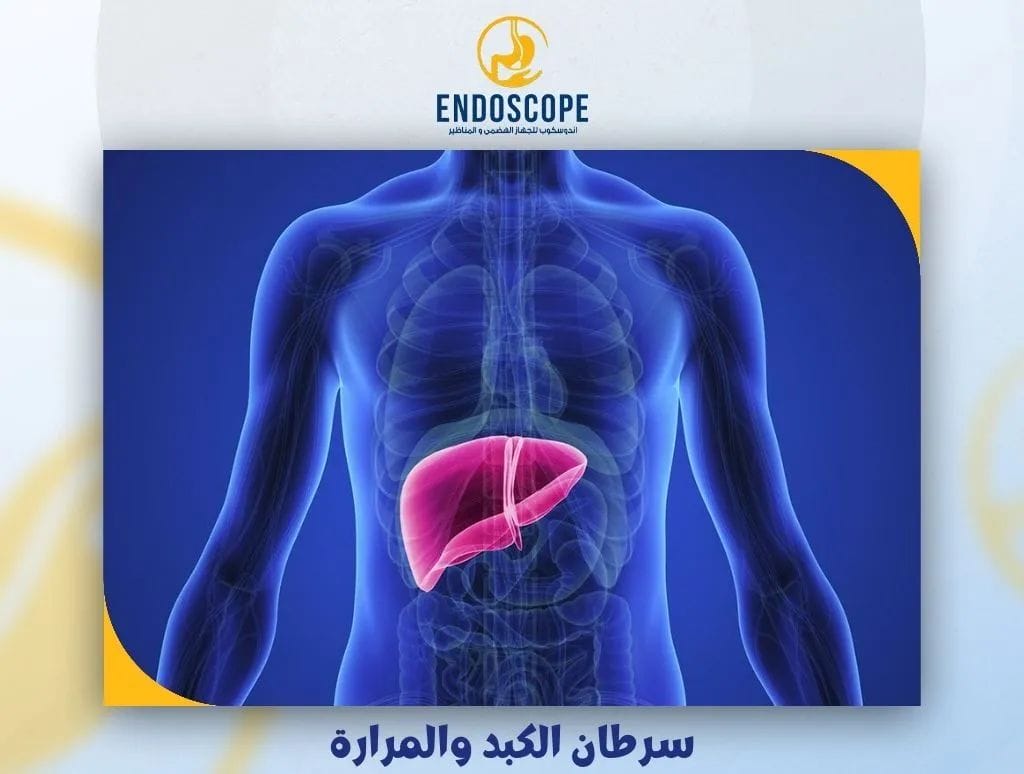 سرطان الكبد والمرارة
