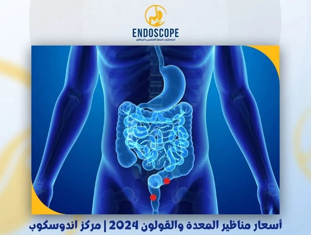 أسعار مناظير المعدة والقولون 2024 | مركز اندوسكوب