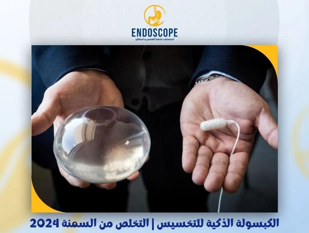 الكبسولة الذكية للتخسيس | التخلص من السمنة 2024