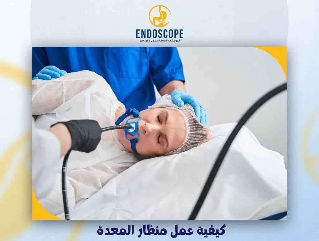كيفية عمل منظار المعدة