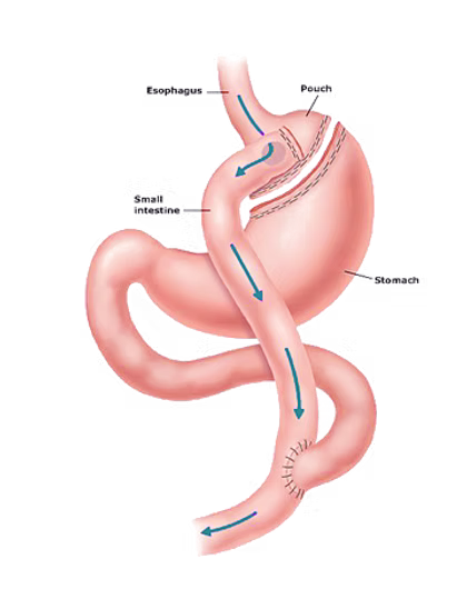 عمليات تغيير المسار