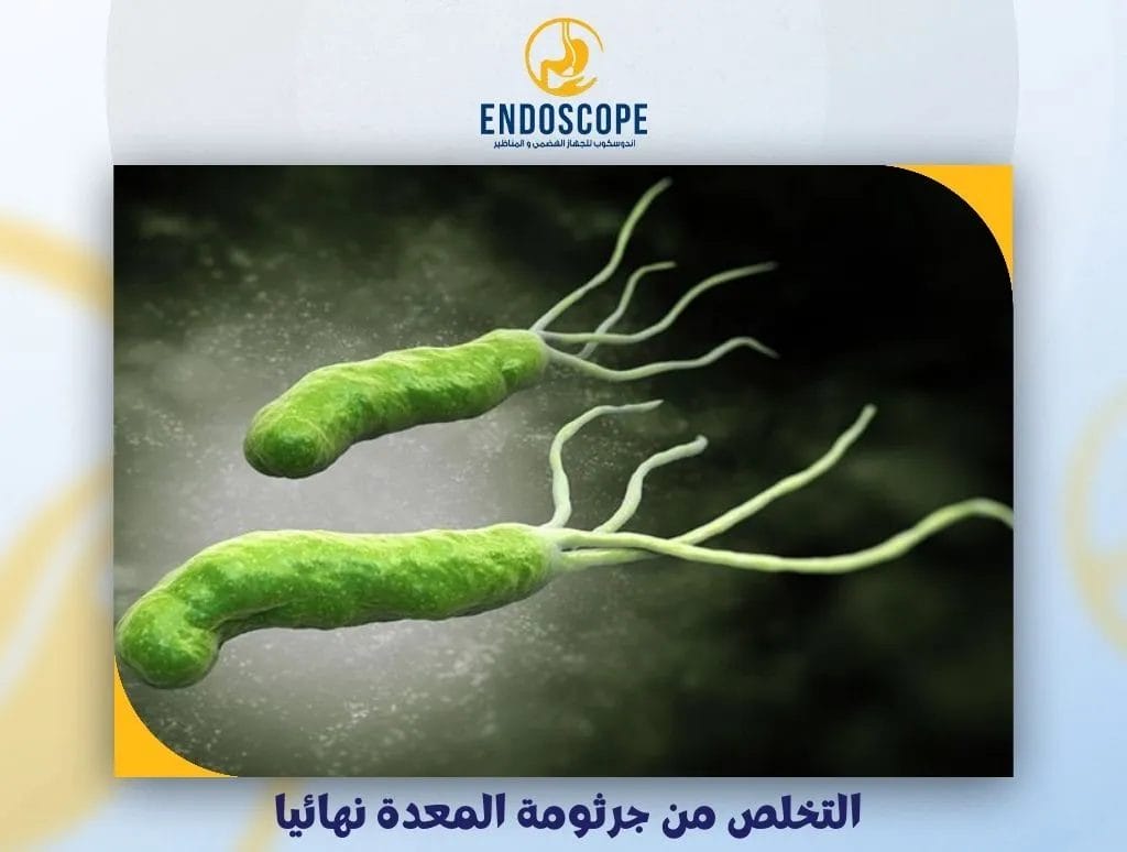 التخلص من جرثومة المعدة نهائيا
