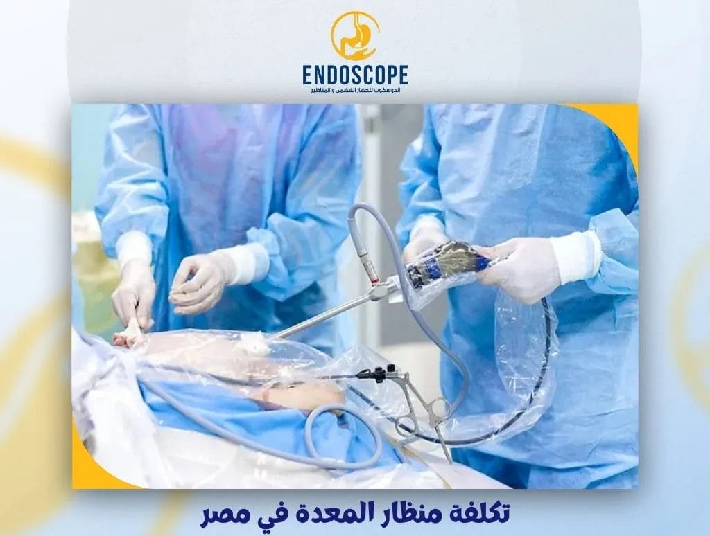 تكلفة منظار المعدة في مصر