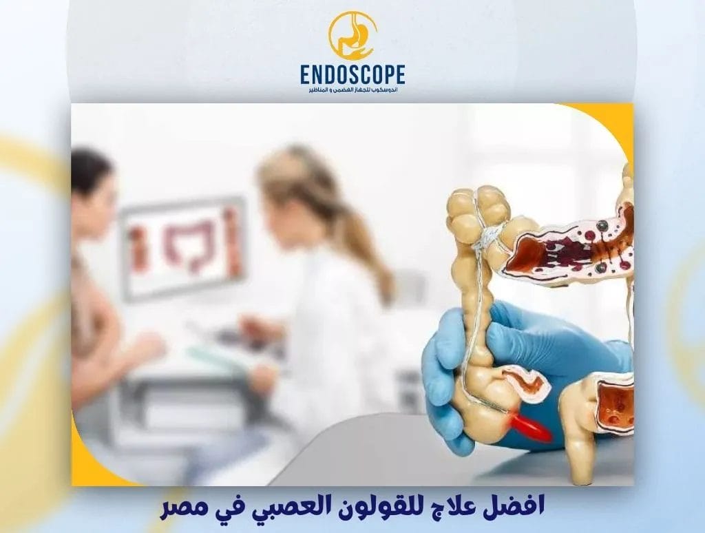 افضل علاج للقولون العصبي في مصر