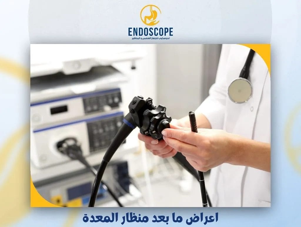 اعراض ما بعد منظار المعدة