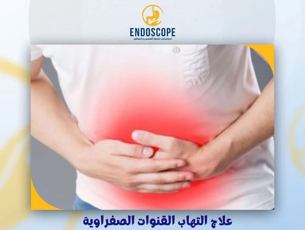 علاج التهاب القنوات الصفراوية