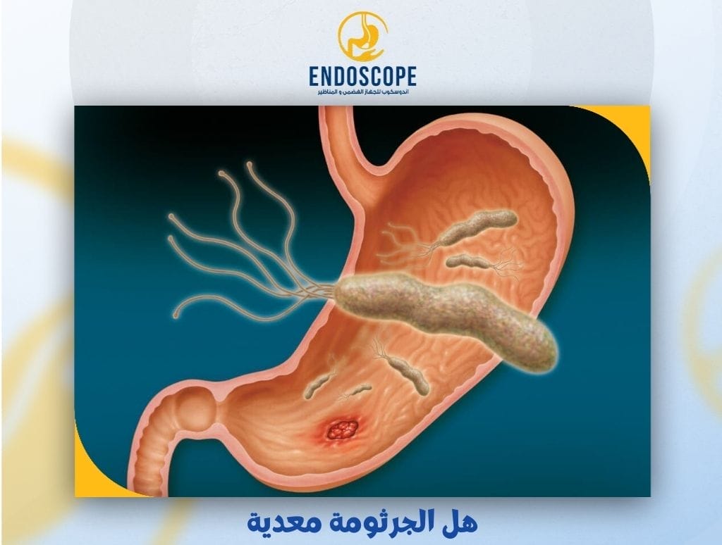 هل الجرثومة معدية