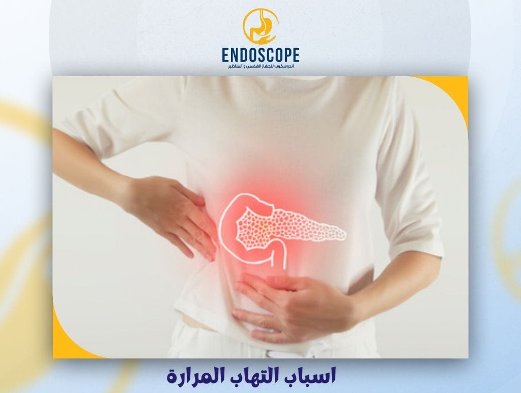 اسباب التهاب المرارة