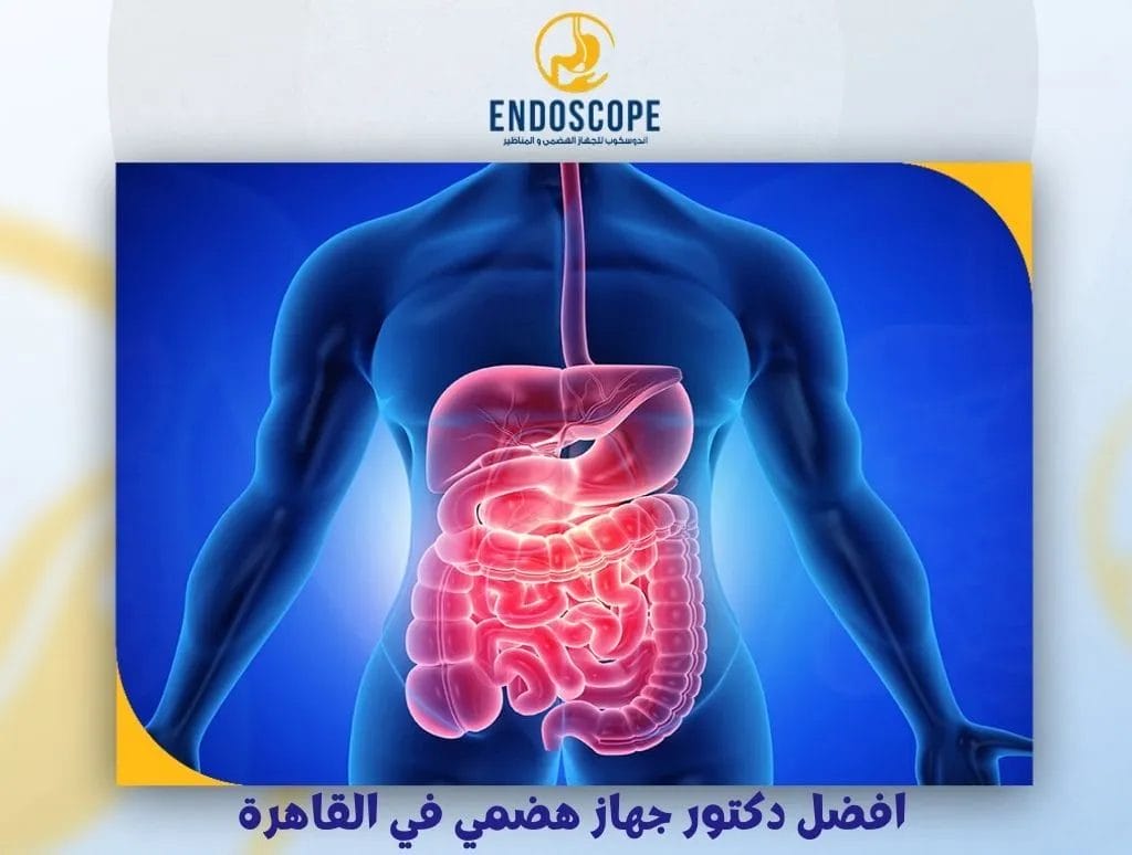 افضل دكتور جهاز هضمي في القاهرة