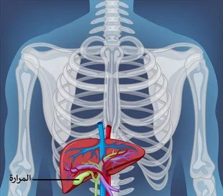 علاج التهاب المرارة