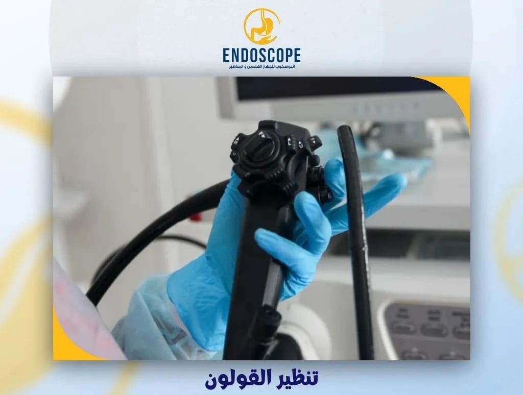 تنظير القولون