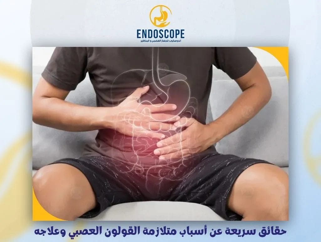 حقائق سريعة عن أبرز أسباب متلازمة القولون العصبي وعلاجه