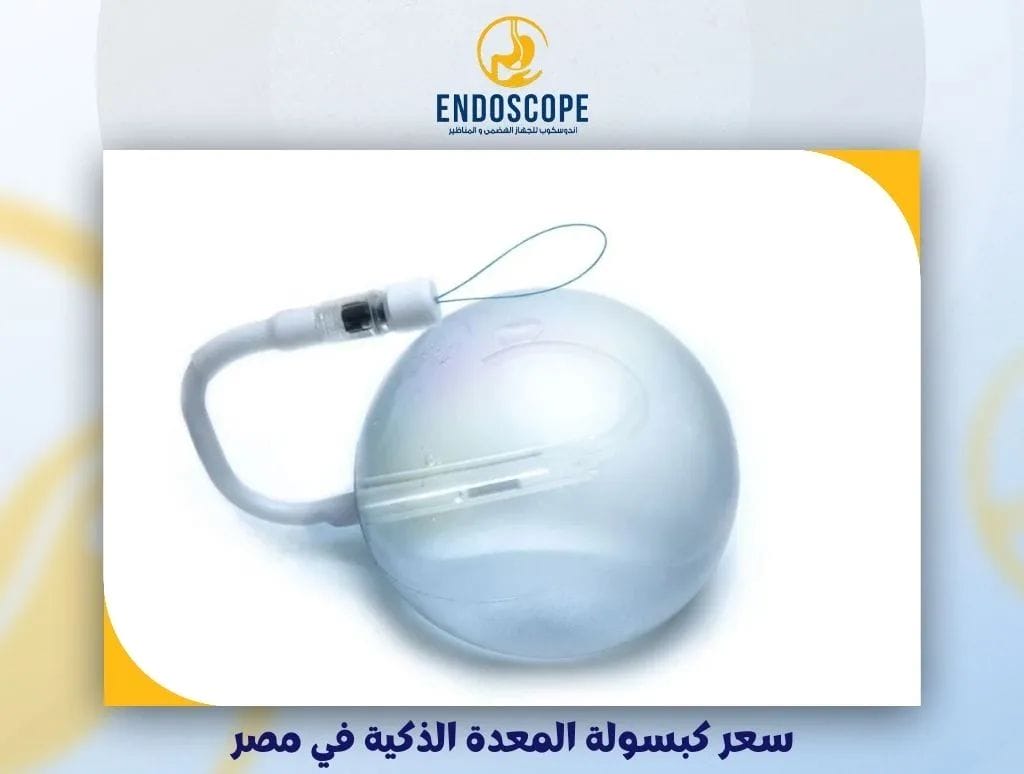 سعر كبسولة المعدة الذكية في مصر