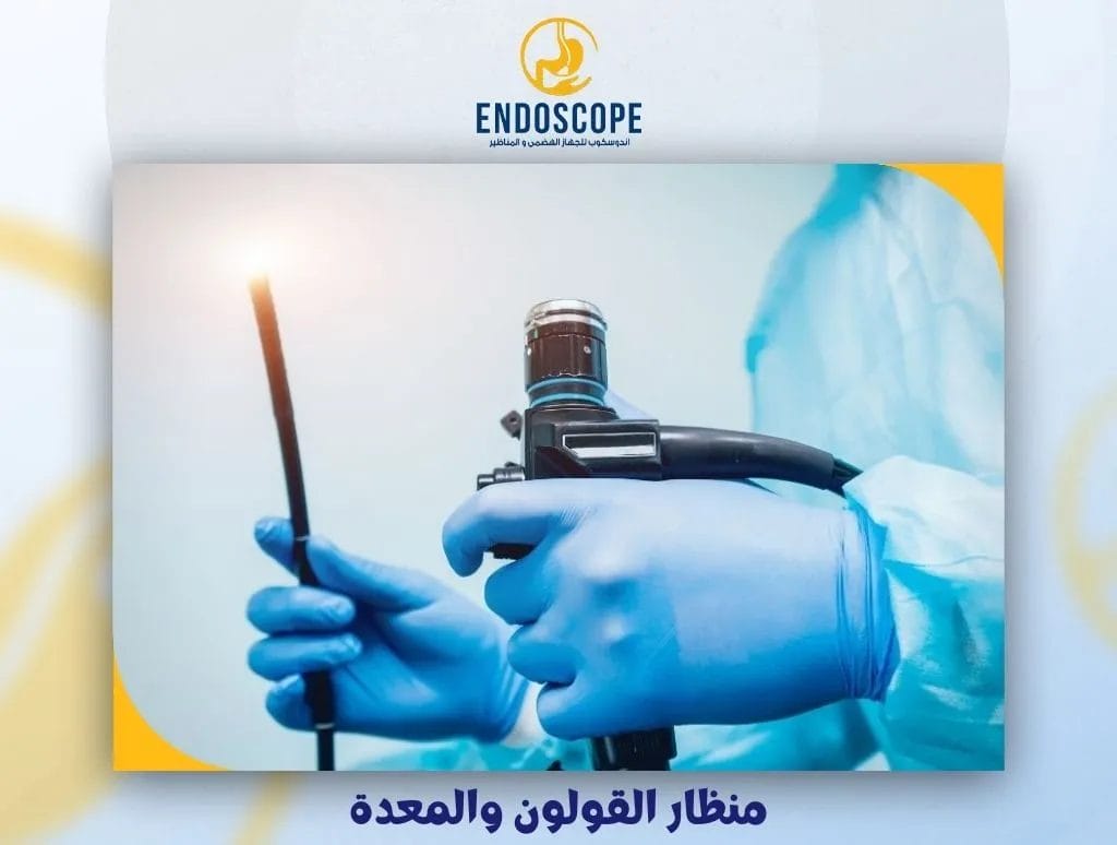 منظار القولون والمعدة