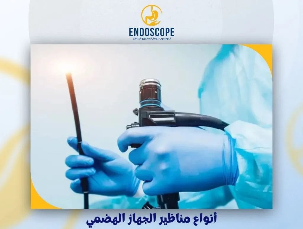أنواع مناظير الجهاز الهضمي