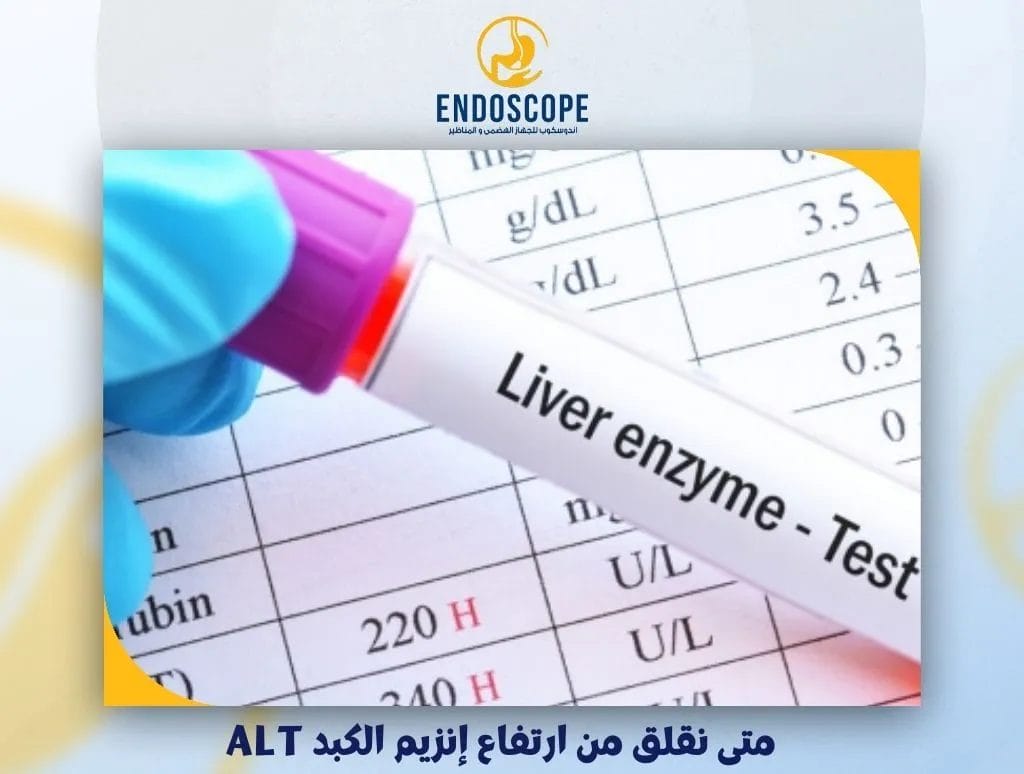 متى نقلق من ارتفاع إنزيم الكبد ALT