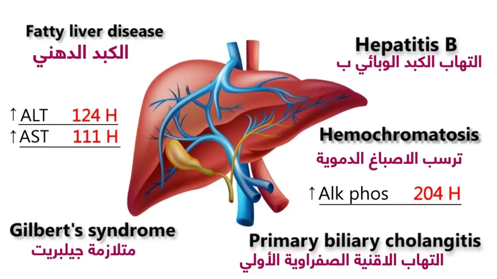 متى يكون ارتفاع إنزيم الكبد GGT خطير ؟