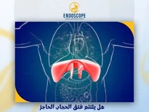 هل يلتئم فتق الحجاب الحاجز