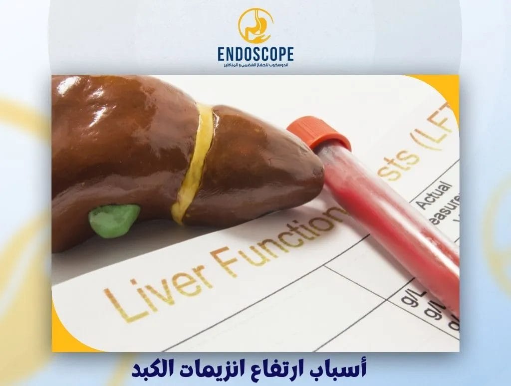 أسباب ارتفاع انزيمات الكبد