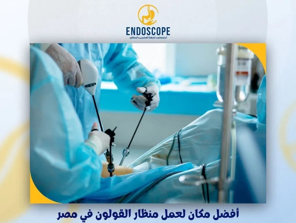 أفضل مكان لعمل منظار القولون في مصر