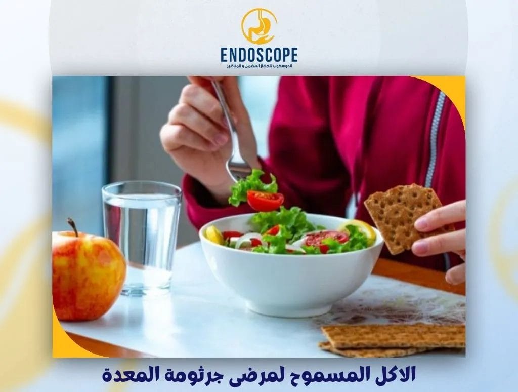 الاكل المسموح لمرضى جرثومة المعدة