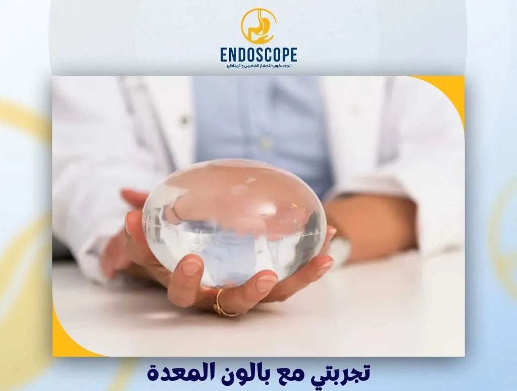 تجربتي مع بالون المعدة