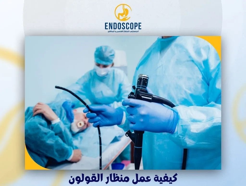 كيفية عمل منظار القولون