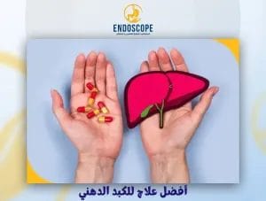 أفضل علاج للكبد الدهني