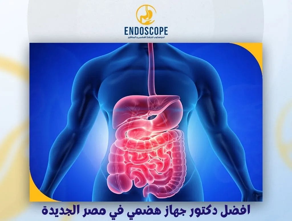 افضل دكتور جهاز هضمي في مصر الجديدة