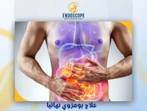 علاج بومزوي نهائيا